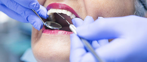 Best Cosmetic Emergency Dentistry in Topanga, CA